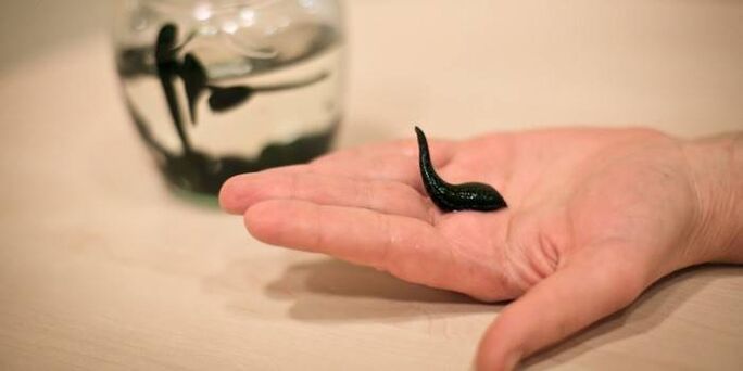 Behandlung mat Leeches