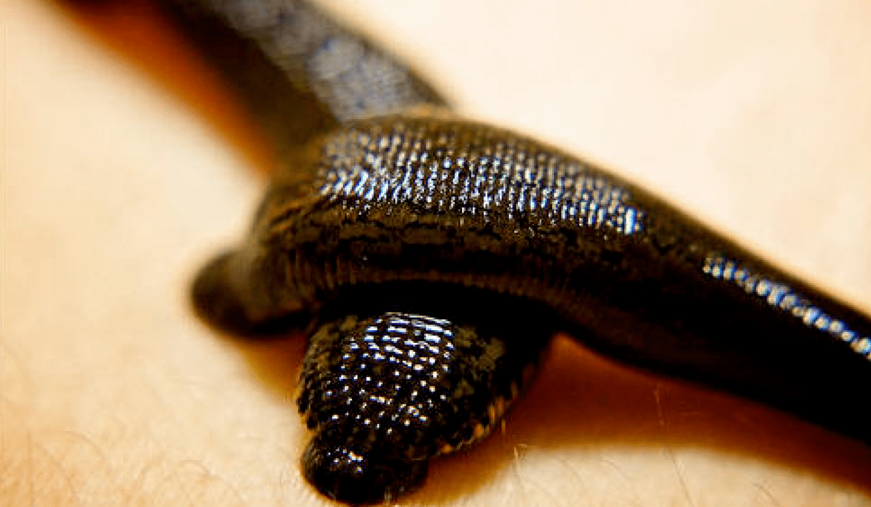 Leech fir d'Behandlung vu Prostatitis